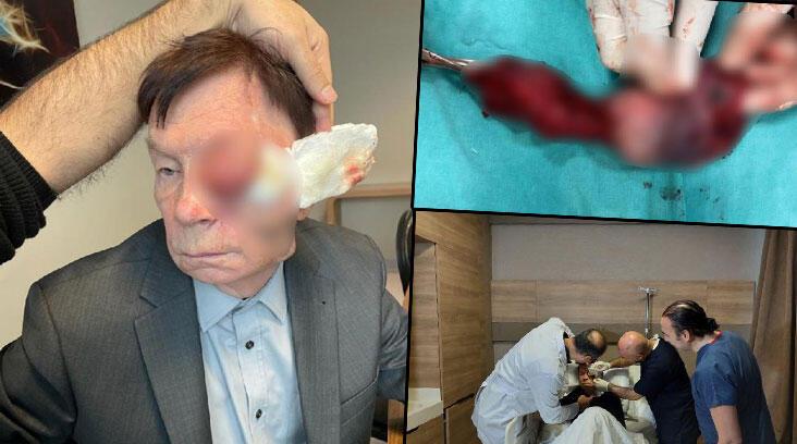 ’15 gün yaşamaz’ denildi, Türk doktorlar inanılmazı başardı! ‘Yaşaması için tek şansı buydu’