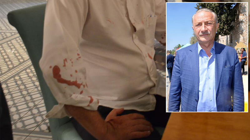 Didim Belediye Lideri Ahmet Deniz Atabay ve avukatına beyzbol sopalı saldırı!