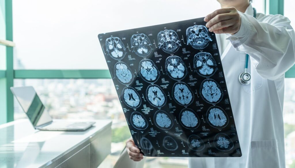 Harvardlı profesör, FDA’nın tartışmalı alzheimer ilacını onaylamasının akabinde istifa etti: ABD tarihindeki en makus kararlardan biri