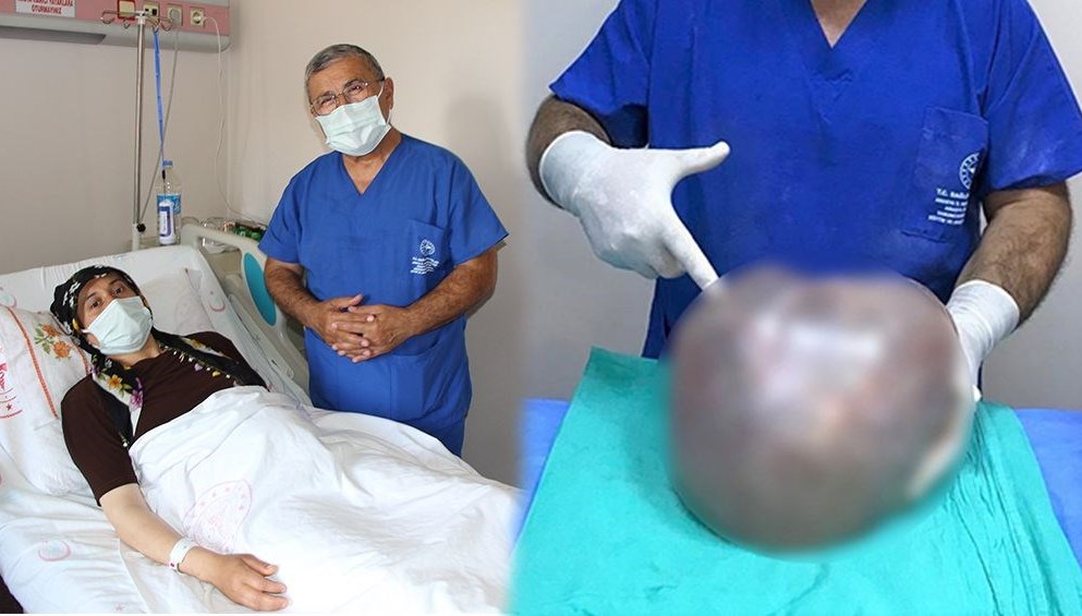 Karnından 6,4 kilo kitle çıktı