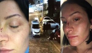 Polisten bayana dayak savı: Tabip az bile benzetmişsiniz dedi