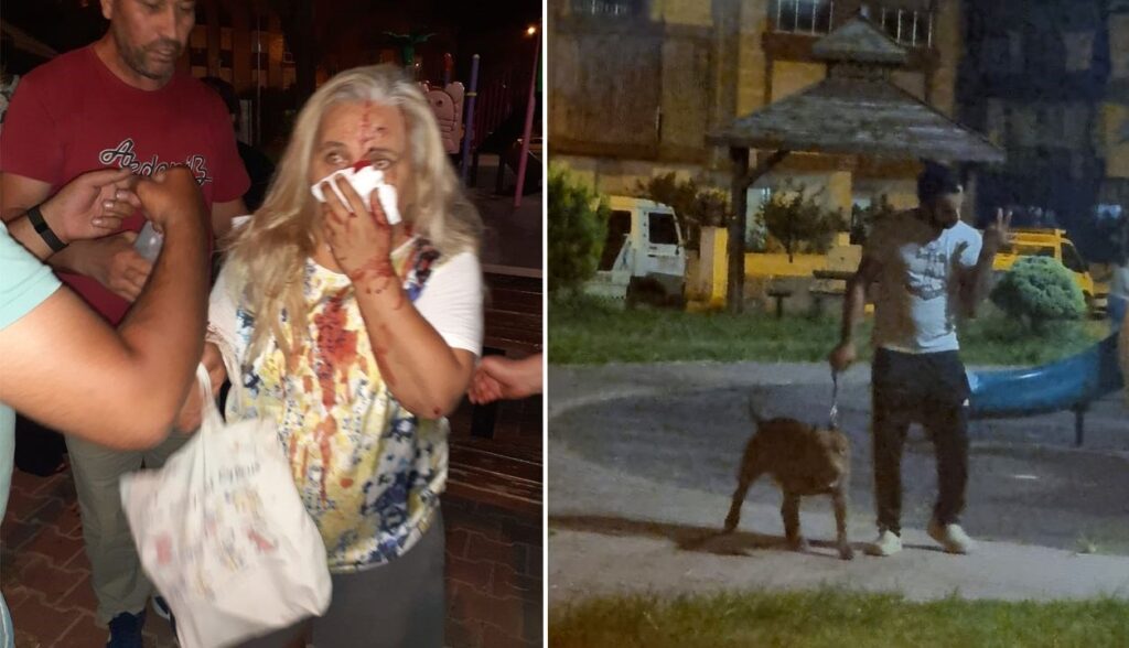 55 yaşındaki kadın çocuk parkında pitbulların saldırısına uğradı