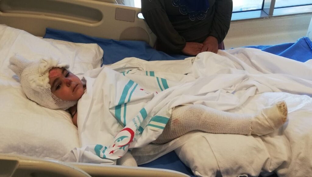 2 yaşındaki Eylül, annesinin ekmek pişirdiği tandıra düştü