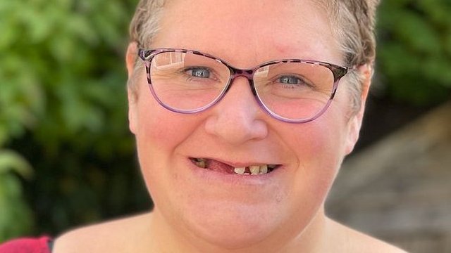 İngiltere’de diş hekimi randevusu yetersizliği: ’11 dişimi kendi ellerimle çektim’