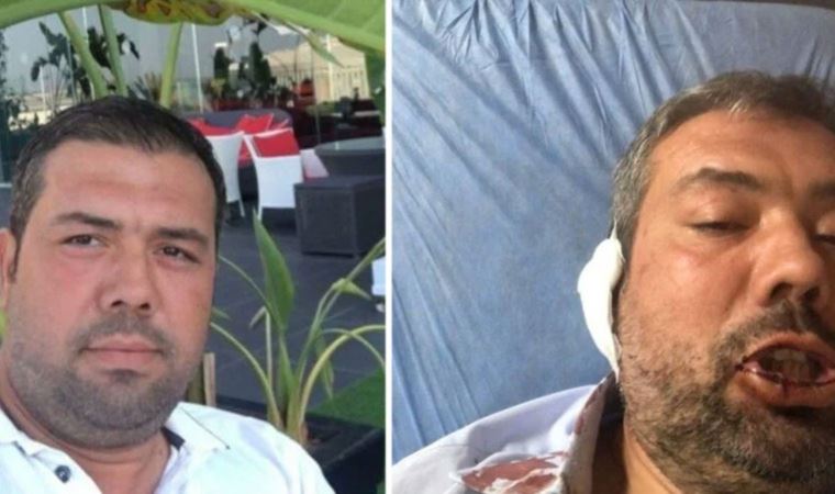 MHP’li belediye aleyhine paylaşım yapan yurttaşa çirkin saldırı