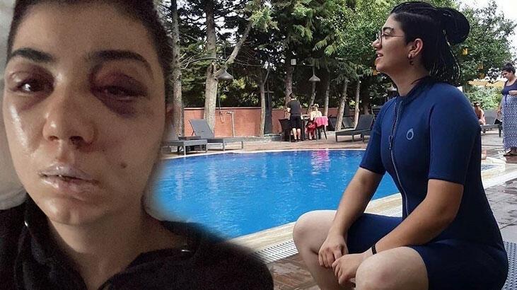 Son dakika… Taksim’de genç kızı felç eden öldüresiye dayak! Ameliyata girersek elimde kalırsın