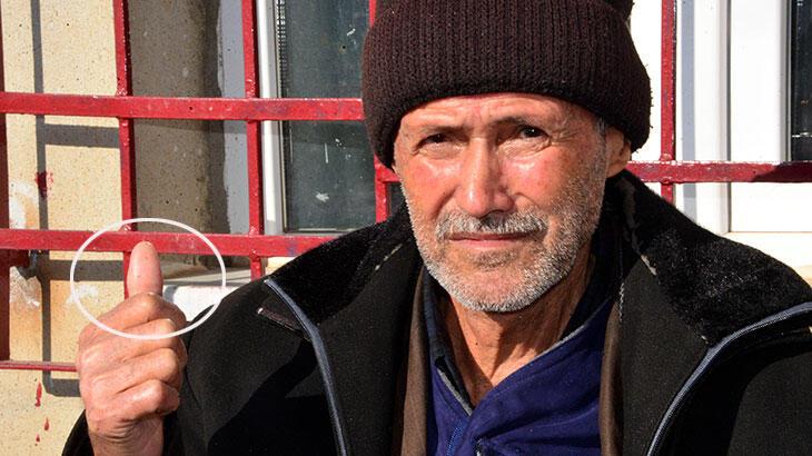 4 milyonluk parmak! Bir günde her şeyini kaybetti