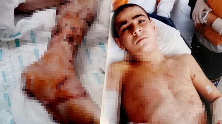 4 yıl önce pitbull saldırısına uğrayan çocuk, travmayı atlatamadı