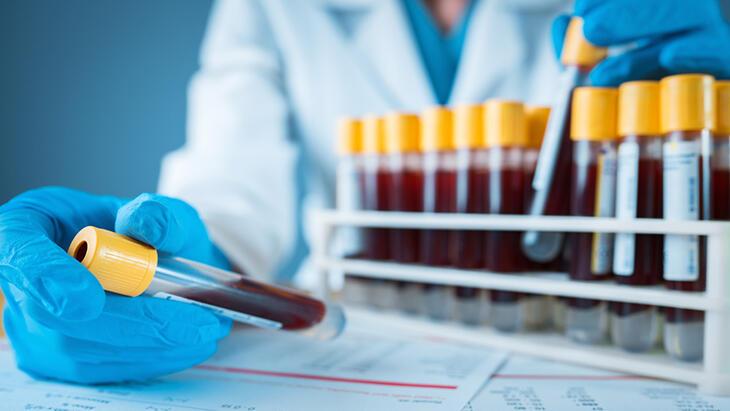 Anne-baba olmadan önce hangi testleri, neden yaptırmalısınız?
