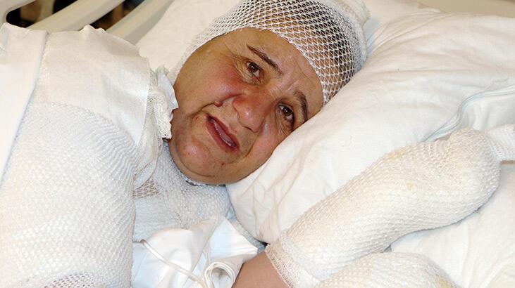 Ekmek pişirirken tandıra düştü! ‘Dayanılmaz acılar çekiyorum’