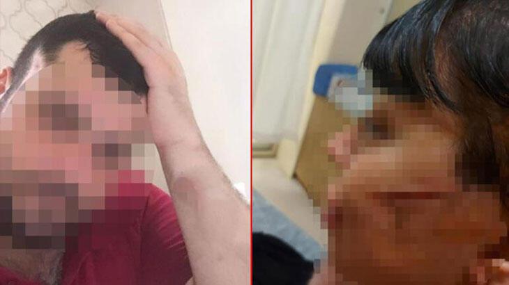 Eski sevgilisinin yüzünü usturayla kesen adam tutuklandı