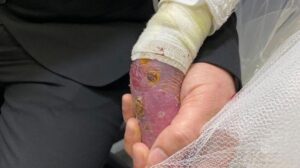 Ölümü göze alıp kaçarak evlendi, çocuğu olduktan sonra gelinlik giydi