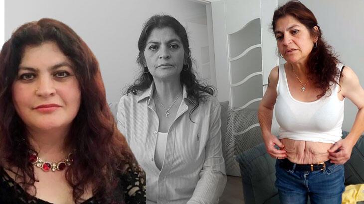 Yaptırdığı estetik ameliyatlar kabusu oldu!