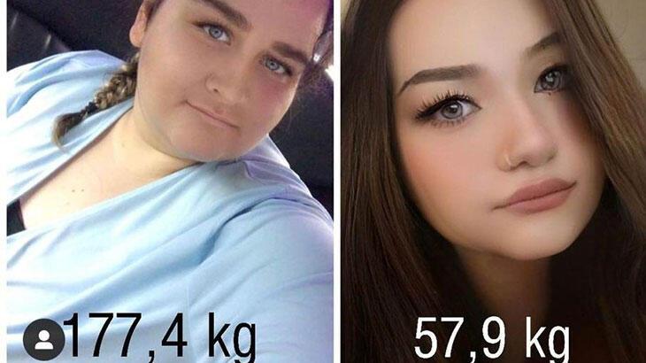 177 kilodan 59 kiloya düştü!