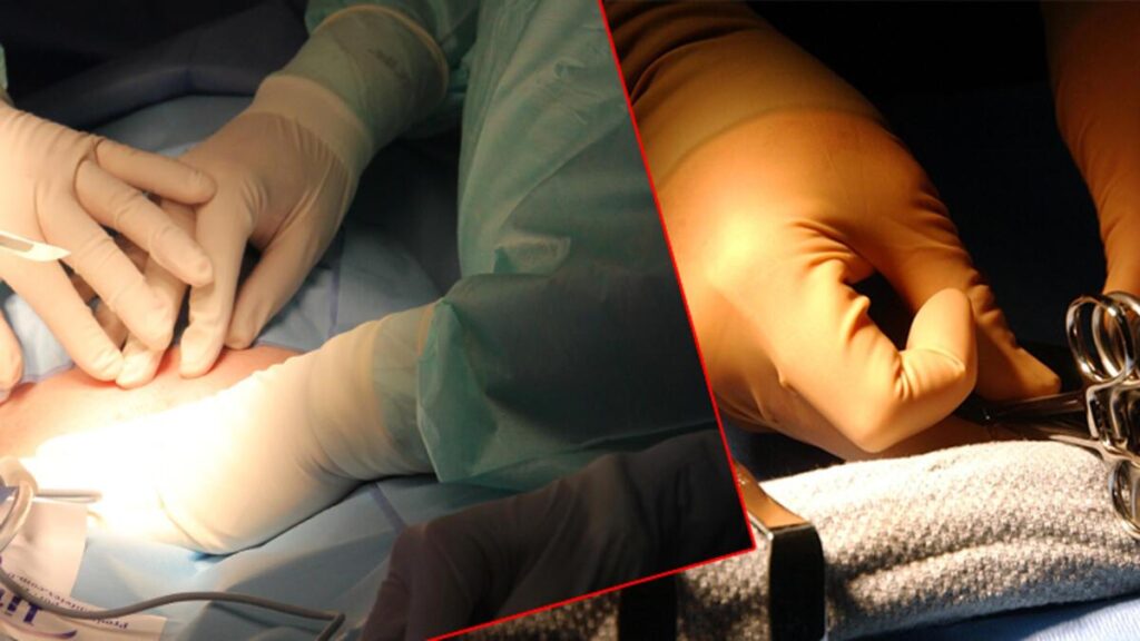 Hastalarının karaciğerine adının baş harflerini yazdı, meslekten men edildi!