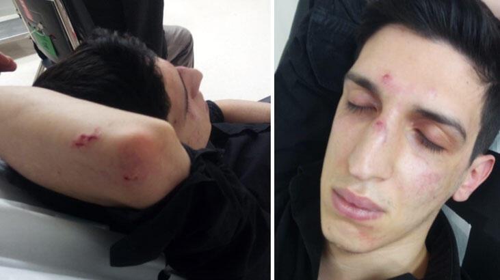 İndi bindi ücretini fazla bulunca taksiciyi dövdü!