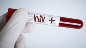Pandemi engel oldu, Türkiye’de 30 bini aştı! HIV, ölümcül değil ama…