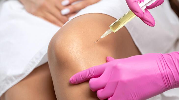 Diz kireçlenmesine 1 tüp kanla enjeksiyon tedavisi