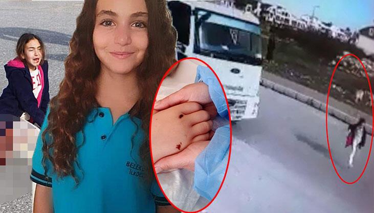 Köpekten kaçarken kamyonun ezdiği Mahra, yaşam savaşını sürdürüyor