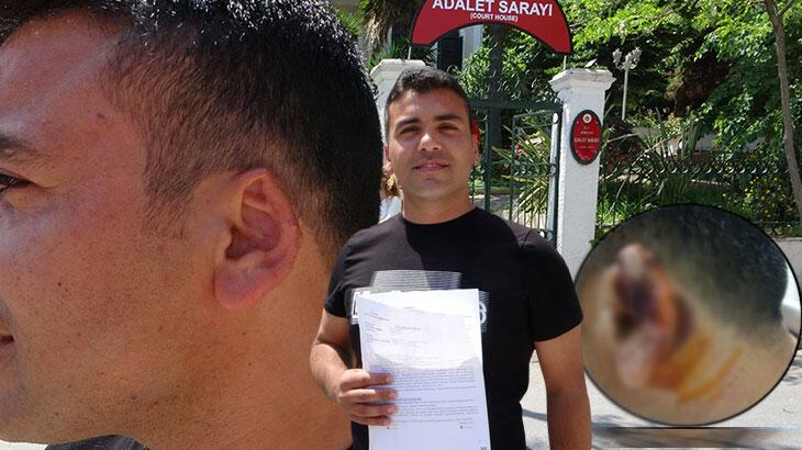 Akılalmaz olay! Kavgada kopan kulağını martı kaptı