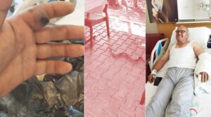 Elini sokan yılanı poşete koyup hastaneye götürdü! “Bu karar hayatımı kurtardı”