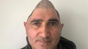 İstanbul’da, doğum gününde bu hale geldi! ‘Mucize adam’ Ali’nin son hali şaşırttı