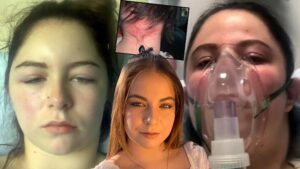 4 saat içinde hayatı karardı! Türkiye’de de saçına bilmeden yapan çok kişi var