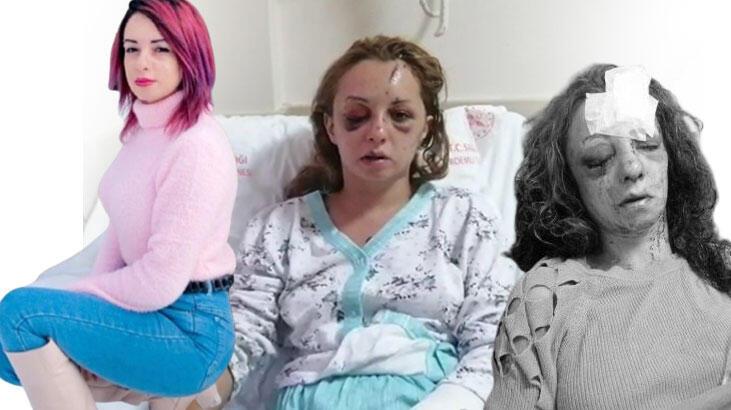 5 gün sonra yoğun bakımdan çıkan Rahime: Mezarlıkta kafama taşla vurdu