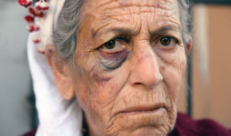 Adana’da dehşet: 72 yaşındaki kanser hastası kadını bayıltana kadar dövdü, para ve altınlarını aldı