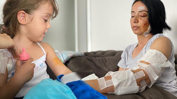 Anne ve kızı dehşeti yaşamıştı! Köpeklerden biri gözlem altında, diğeri aranıyor