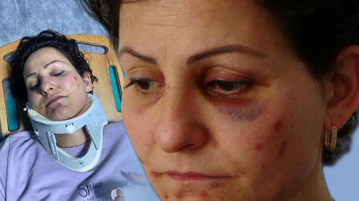 Araçla takip etti, yanlarına yaklaşıp saldırdı! Anne ve kızına öldüresiye dayak