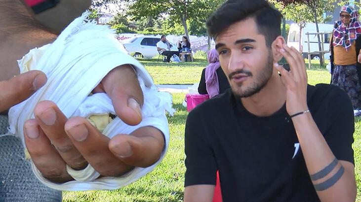 Asker uğurlamasında dehşet! Elinde meşale patlayınca yaralandı