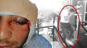 Ayırmaya çalıştığı kavgada gözünü kaybetti! İçki şişesi ‘silah’ sayıldı