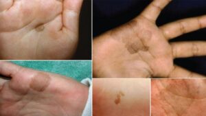 Bir gecede ortaya çıkan ‘şeytan kınası’ gerçeği! ‘Ayırt edilmesi hayati öneme sahip’