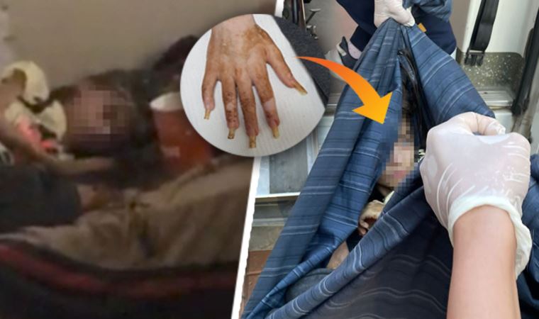 Bursa’da çöp evde bakımsız haldeki çocuğu bulan temizlik işçileri yaşadıklarını anlattı