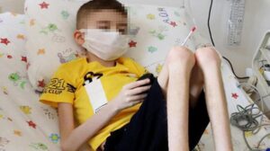 Bursa’da çöp evde bulunan Cem’den iyi haber! 3 kilo daha aldı