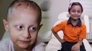 Ceylin pembe tokasına kavuştu! Saçları yok diye kanser sanıyorlardı