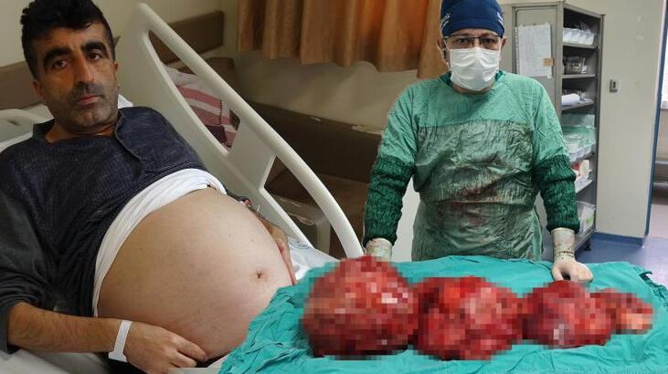 Doktorları şoke eden olay! Kilo aldığını sanıyordu gerçek şoke etti