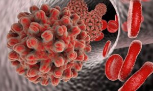 Dünya Hepatit Günü: Hastalıktan nasıl korunmalı?