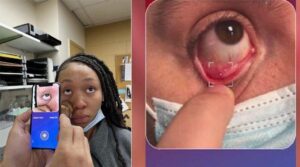 Dünyada ilk! Türk hekimden çığır açacak buluş: Kansızlık hastanın gözünden anlaşılacak