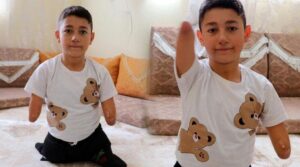 En büyük hayali okula gitmek! Nakşin protez istiyor