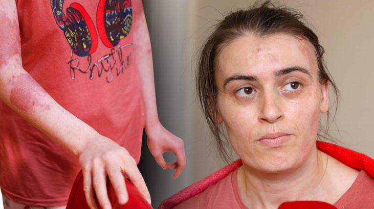 Gaziosmanpaşa’da eski elti dehşeti: 17 kez bıçaklayıp, üzerine kaynar su döktü