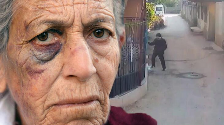 Kanser hastası yaşlı kadını 20 dakika dövdü! Altınları olduğunu biliyordum