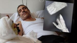 Kopan 3 parmağını poşete koydu hastaneye koştu