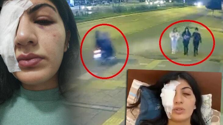 Motosikletten attıkları cisimle Hatice’yi gözünden yaralayan 2 şüpheli adliyede