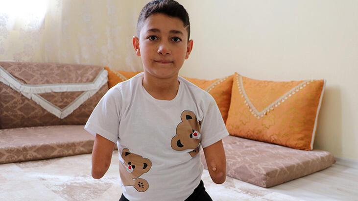 Nakşin’in tek isteği protez kol ve bacak