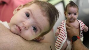 Organları göğüs kafesinde doğan Lena bebeğe hayat veren dokunuş