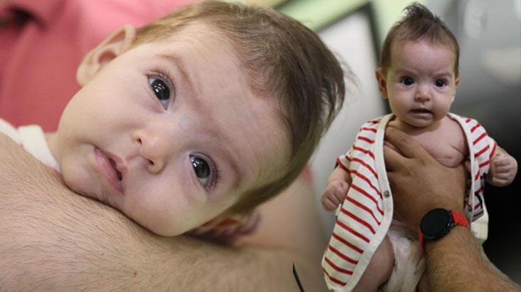 Organları göğüs kafesinde doğan Lena bebeğe hayat veren dokunuş