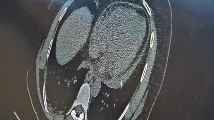 Profesör açıkladı! ‘Şuan herkeste hastalık yapmayacak kadar bir koronavirüs mevcut’