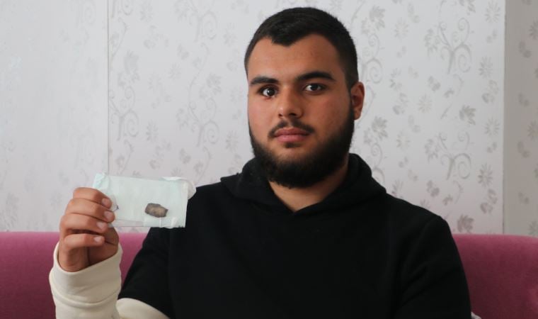 Şampiyonluk kutlamasında gözünü kaybetti, savcılık takipsizlik verdi